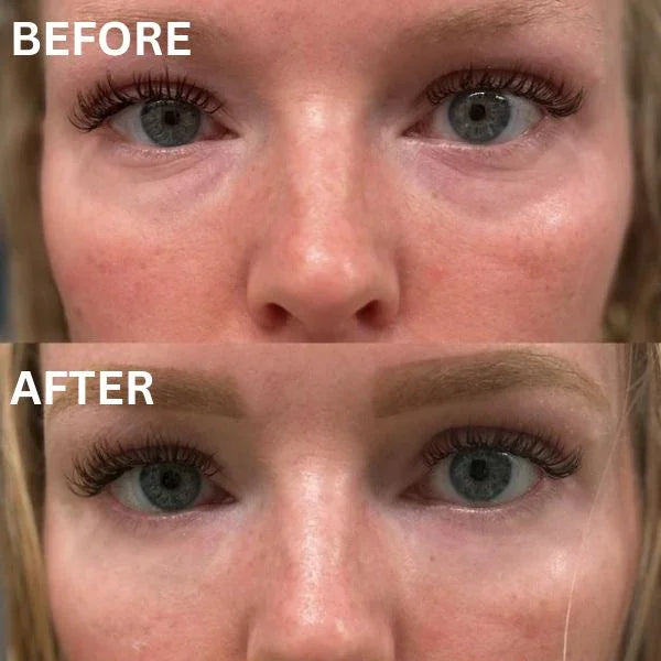 Skinuretic™ - Instant Firm Collagen Eye Patches