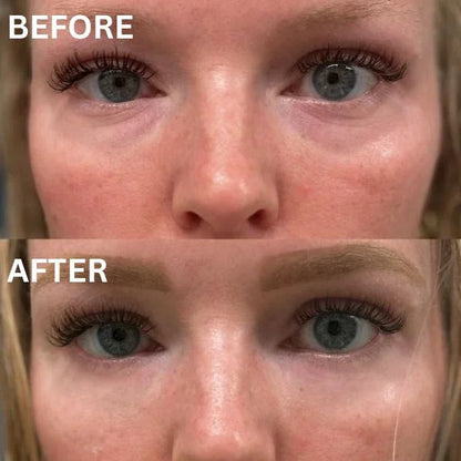 Skinuretic™ - Instant Firm Collagen Eye Patches