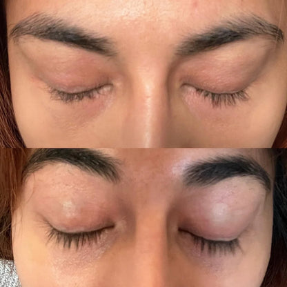 Skinuretic™ - Organic Castor Oil Roll-On