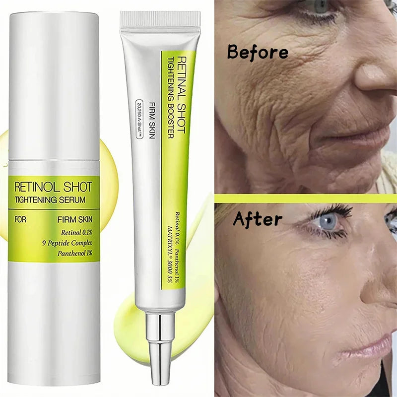 Skinuretic™ - Vita A Retinal Shot Tightening Booster