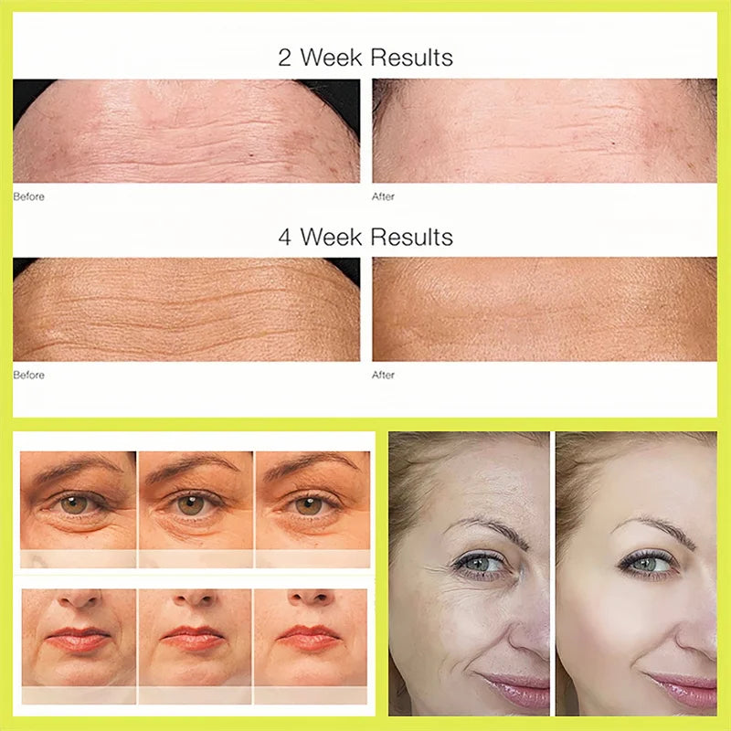 Skinuretic™ - Vita A Retinal Shot Tightening Booster